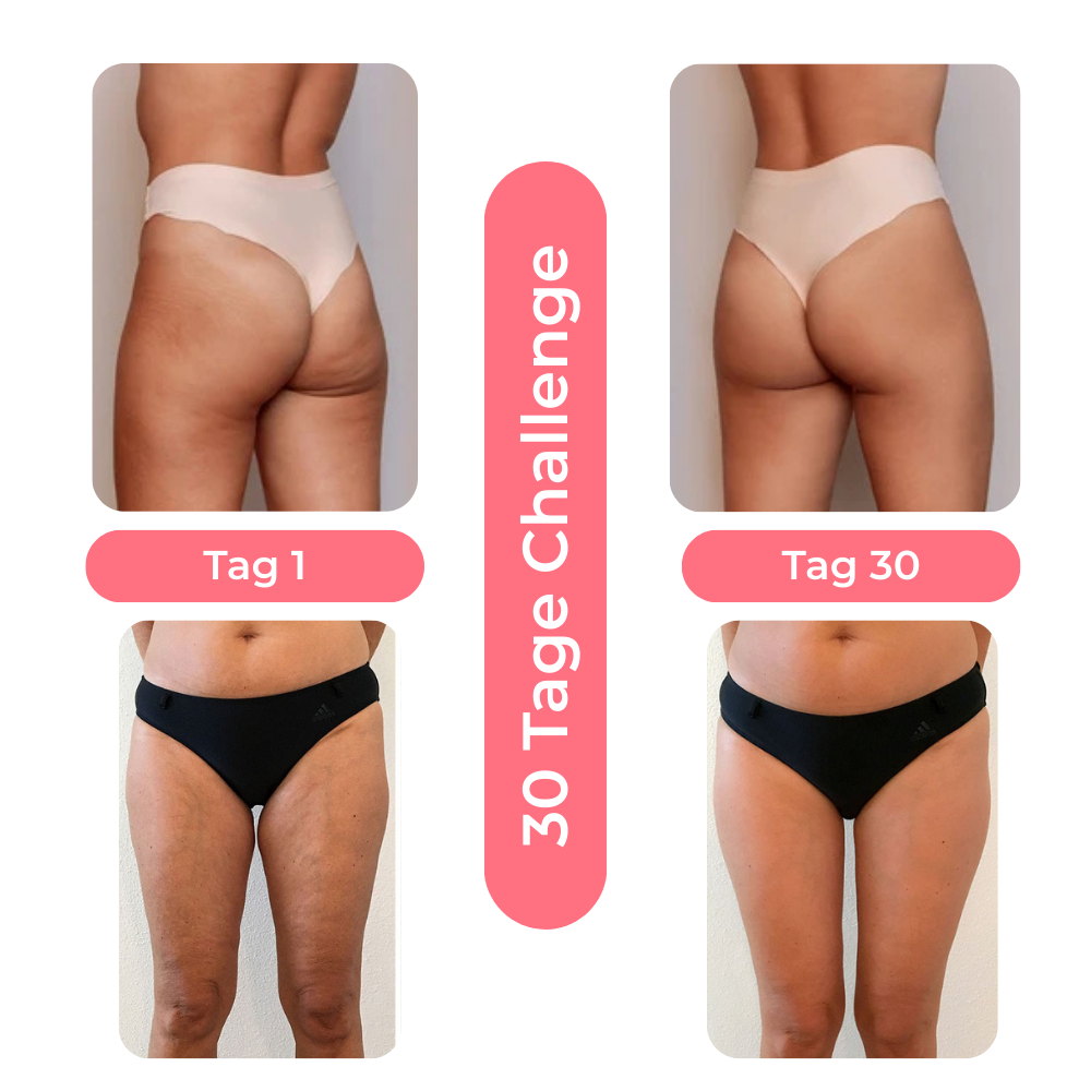 Steinsee Cellulite Massage Pro