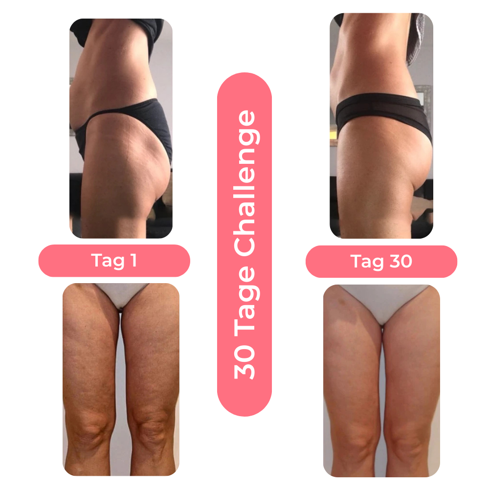 Steinsee Cellulite Massage Pro