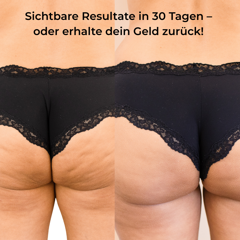 Steinsee Cellulite Massage Pro